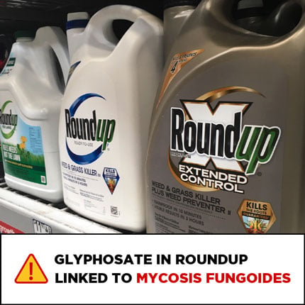 Roundup-mycro-fungoides-1